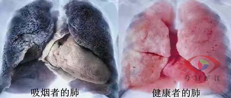 安定镇：吸烟有害健康，尽早戒烟好处多